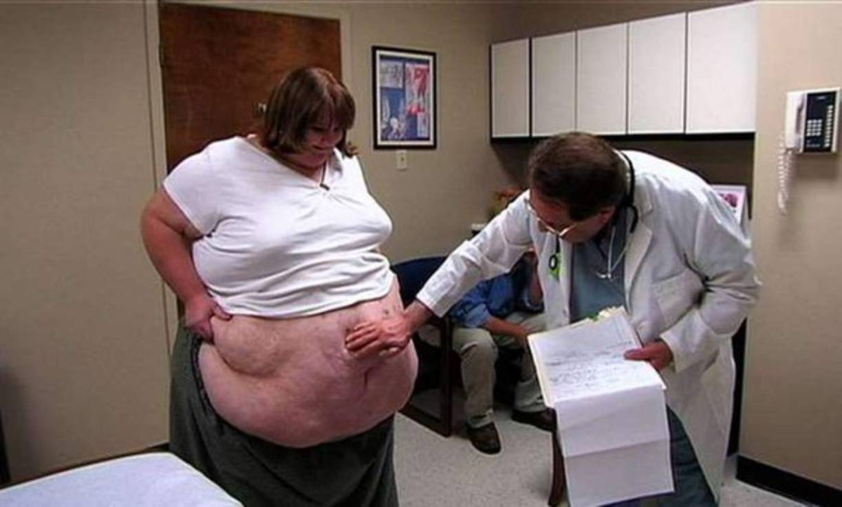 Ella nunca alcanzó a perder el peso que se necesitaba para intervenirla quirúrgicamente, pero se tuvo que hacer la operación, ya que era de 'vida o muerte'.