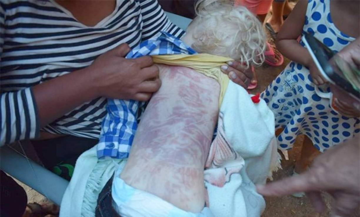 Los padres del niño albino sí creían que su hijo aún estaba con vida y por eso le estuvieron dando agua con la esperanza de que regresara a la vida.