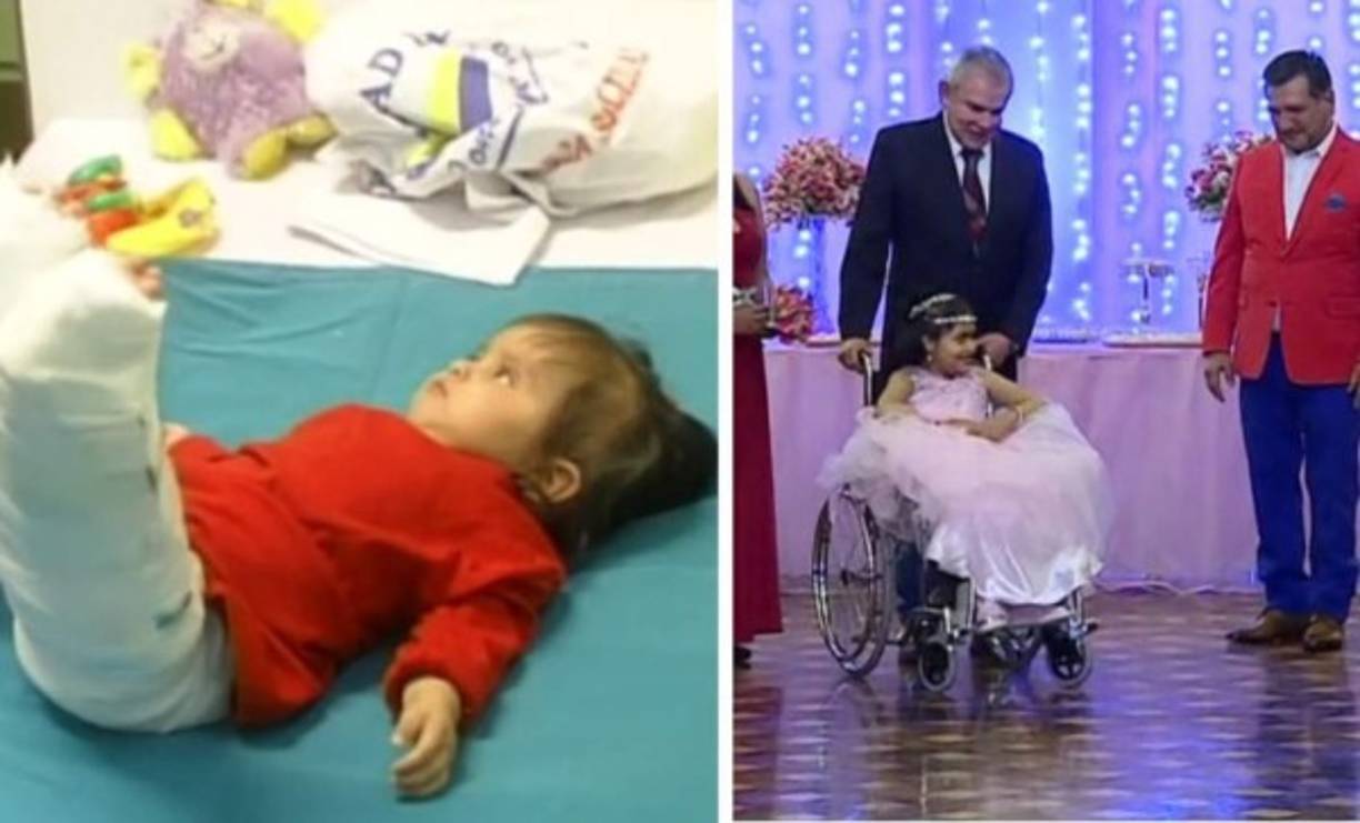 El caso conmovió a Perú en 2004, movilizando a autoridades y médicos que ofrecieron operarla para separar sus piernas y mejorar su calidad de vida. Fue operada 11 veces.<br/><br/>