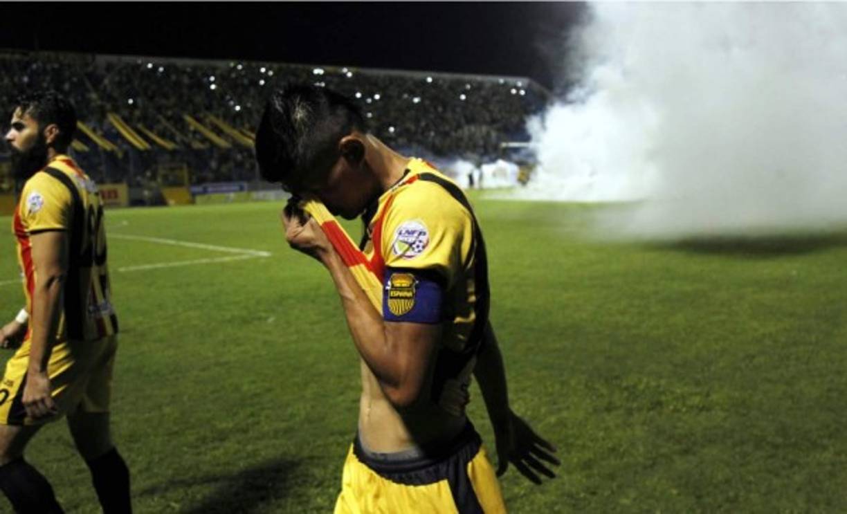 Edder Delgado, capitán del Real España, afectado por el gas lacrimógeno.