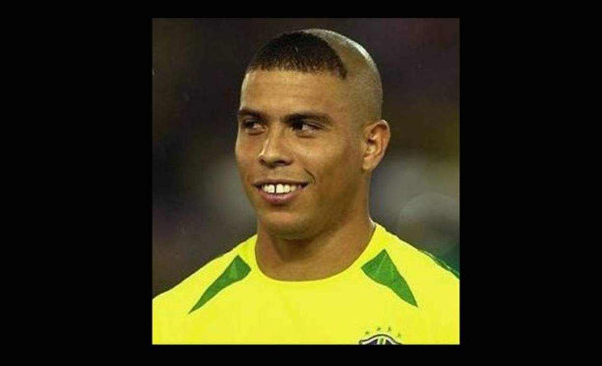 Prestigiosas universidades del mundo se siguen preguntando qué fallo en el ADN provocó que a Ronaldo se le ocurriera aparecer en el Mundial de Alemania 2006 con semejante peinado, pero no hay respuesta.