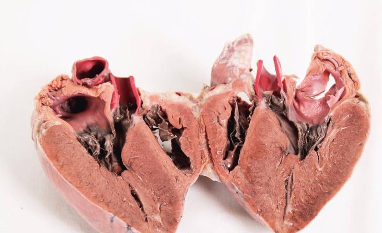 Ramos había plastinado el primer corazón de Centroamérica, proceso que consiste en extraer los líquidos corporales por medio de solventes como la acetona fría, para luego sustituirlos por resinas elásticas de silicona y rígidos de epóxicas, para preservar los órganos, esto con fines académicos y de investigación.