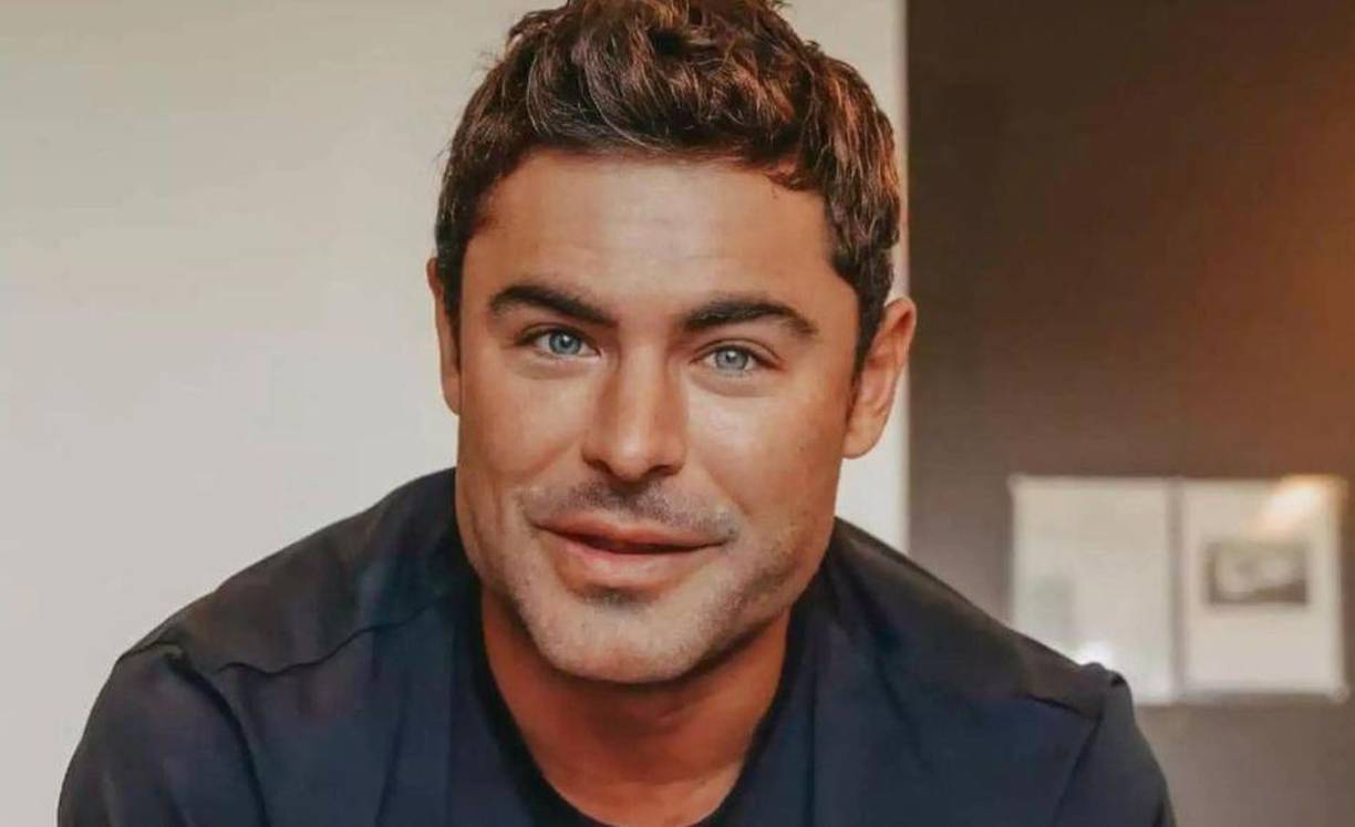 El actor, de 34 años, reveló recientemente que su rostro dramáticamente diferente fue el resultado de una mandíbula rota después de golpearse la barbilla con una fuente de granito, después de que su nueva apariencia provocó especulaciones de que había pasado por el quirófano.