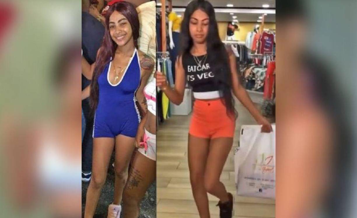 Por lo que parece, entre los retoques que se ha hecho estaría un aumento de pecho, otro de glúteos y ácido hialurónico en los labios.