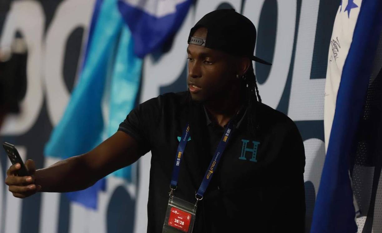 Antes del partido, Alberth Elis se tomó fotos con los aficionados en el estadio. El delantero no jugó por una fractura en el brazo izquierdo.