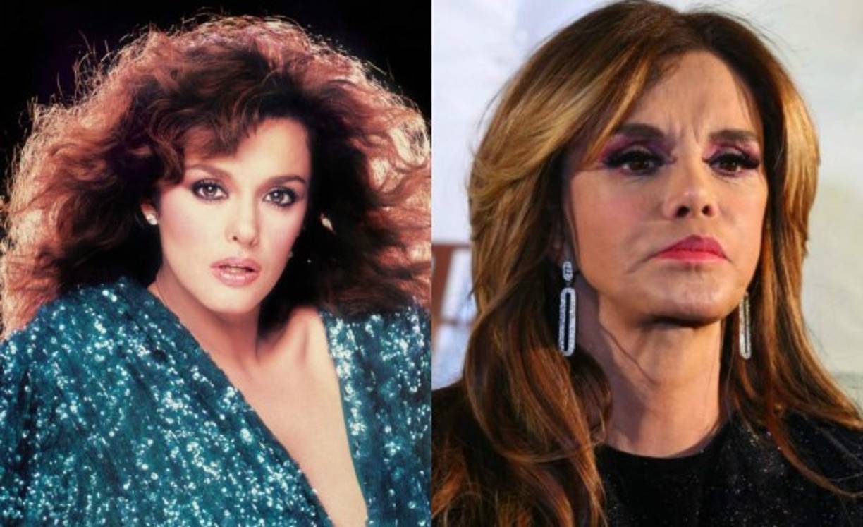 Méndez no niega que se ha realizado cirugías plásticas; sin embargo, ella asegura que no es del tipo de personas que se la 'pasa en el quirófano'.