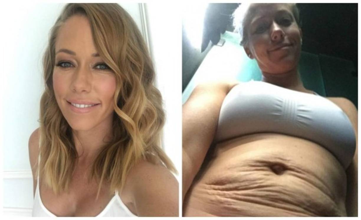 Kendra Wilkinson.<br/><br/>La ex conejita de 'Playboy' y estrella del reality 'The Girl's Next Door' hace algunos años decidió alejarse de los reflectores y formar una familia. En mayo de 2016, para celebrar el Día de la Madre en Estados Unidos, Kendra publicó una imagen en Instagram en donde mostró las estrías en su vientre: 'Vean lo que hicieron mis dos hijos… Me hacen muy feliz', expresó.<br/>