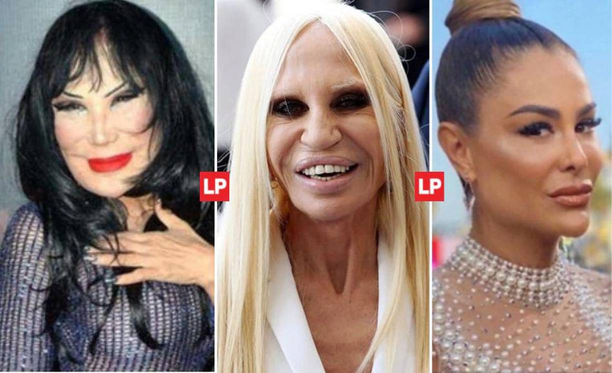 Los procedimientos estéticos no siempre resultan tan bellos como todos creen y esta lista de famosos le hará pensar dos veces antes de hacerse alguna cirugía