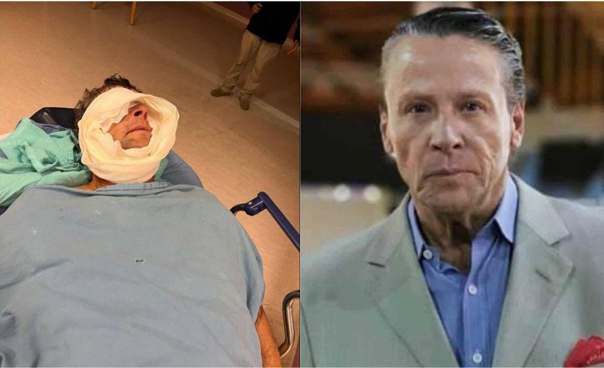 El actor tuvo una confrontación que le provocó un par de heridas graves en el ojo.