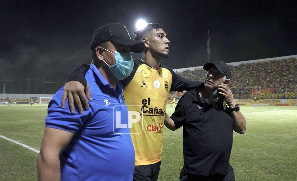 Mayron Flores salió lesionado en el Real España.