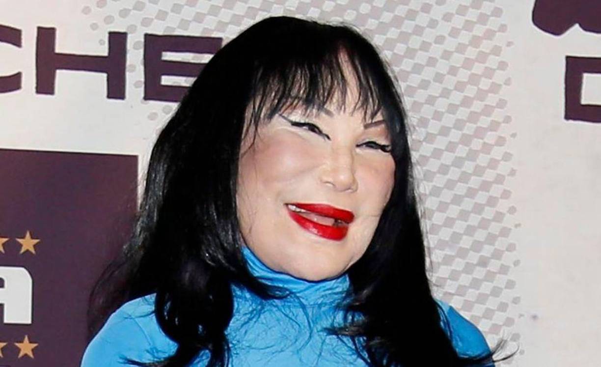 Lyn May: En su juventud ella fue una vedette y actriz mexicana, que un día decidió realizarse algunas cirugías estéticas para mantenerse hermosa con el paso de los años, sin saber que terminaría por dañar su cara.