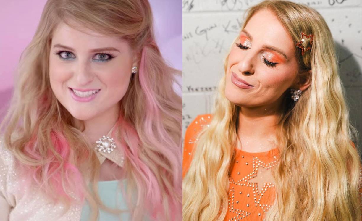 “¡Me puse demasiado bótox y necesito ayuda!” admitió la cantante de “No” durante un episodio reciente de su podcast “Workin’ on It” junto a su hermano Ryan Trainor y su esposo, Daryl Sabara.