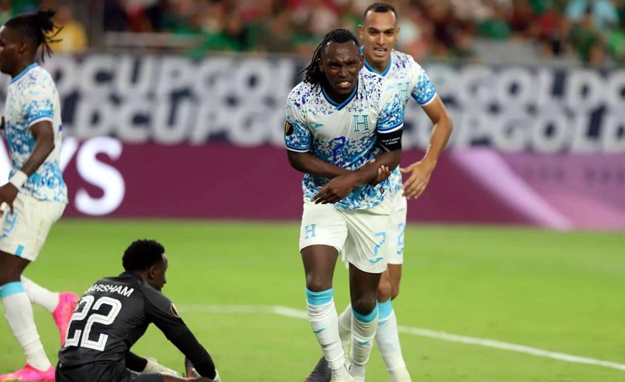 Alberth Elis se lastimó su brazo izquierdo al momento de la caída tras impactar el balón con su pie para marcar el gol del empate de Honduras.