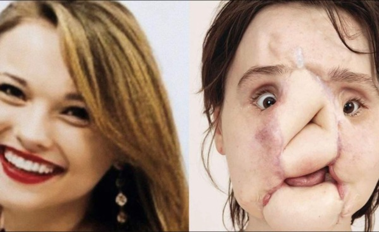 Katie Stubblefield una joven estadounidense acaparó portadas de los medios de comunicación en la década de los 2010, fue nombrada por National Geographic como la noticia e imagen impactante de esa década; su historia conmovió al mundo. <br/><br/>Fotos: Familia Stubblefield y Maggie Steber