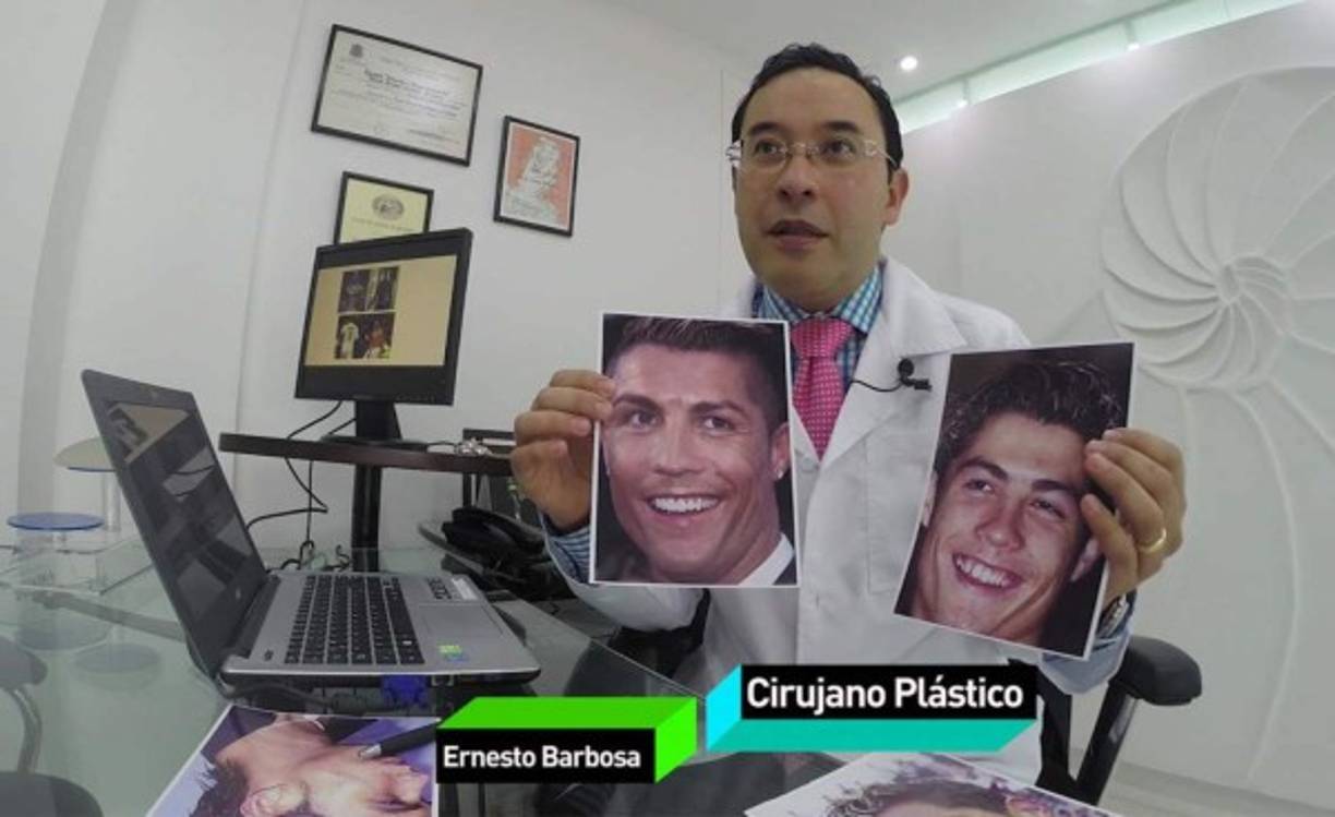 En esta ocasión, se ha viralizado la información en donde el cirujano plástico Ernesto Barbosa de Colombia contó todas las cirugías a las que se ha sometido el crack portugúes Cristiano Ronaldo que milita en la Juventus.