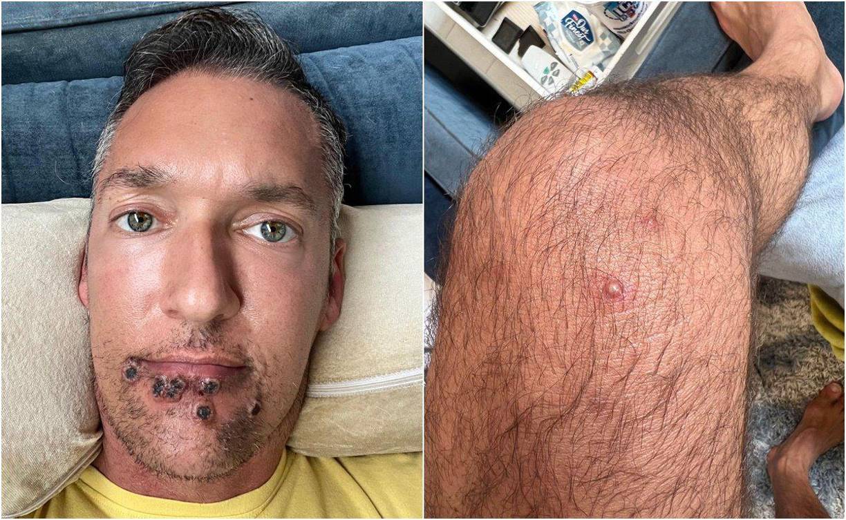 El actor mostró las lesiones que tiene en su rostro y en sus piernas.