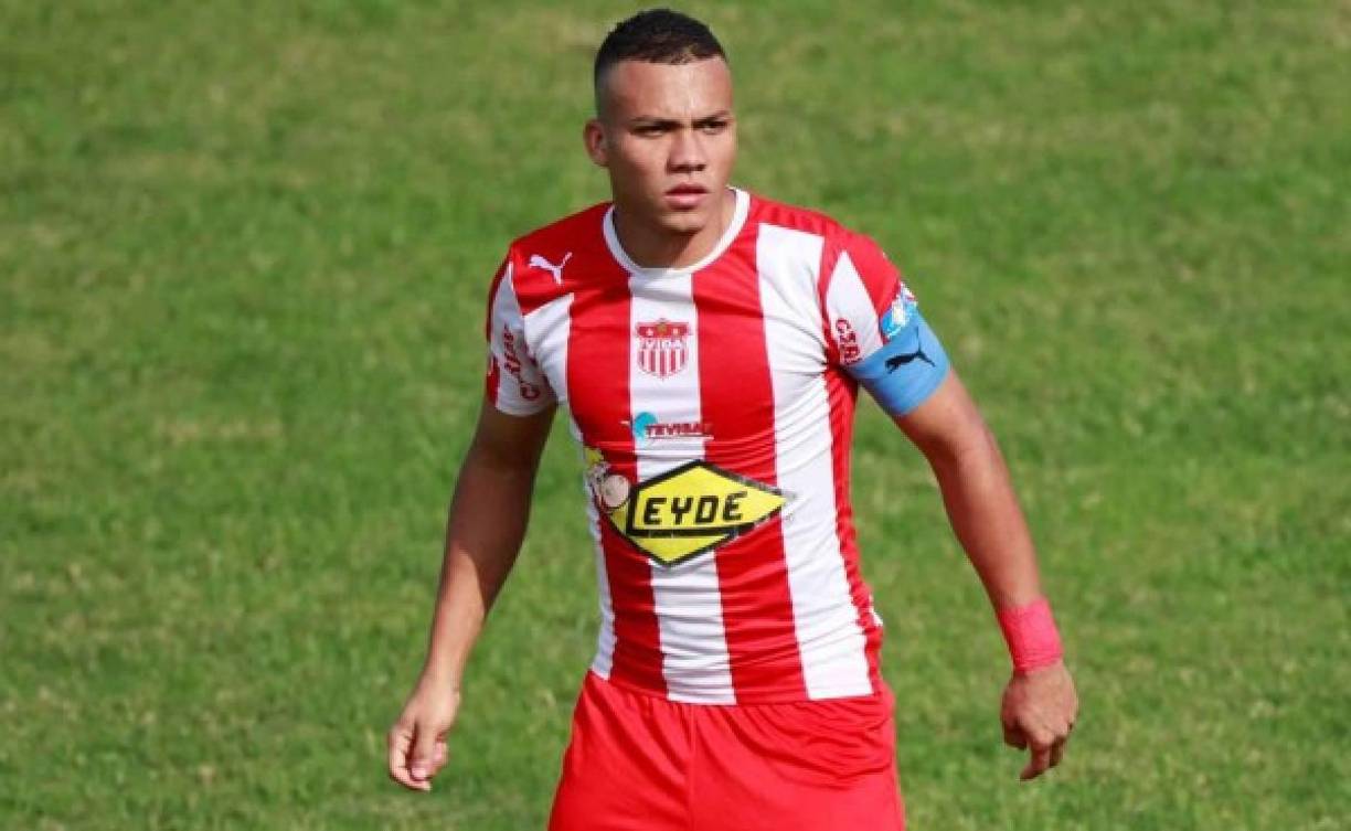 Arnold Peralta : Jugador de mucha entrega y safricio que jugó como volante y lateral derecho. Debutó en el 2008 con el CDS Vida para luego jugar con el Rangers de Escocia. También fue parte del Olimpia. Lastimosamente en diciembre del 2015 fue vilmente asesinado.
