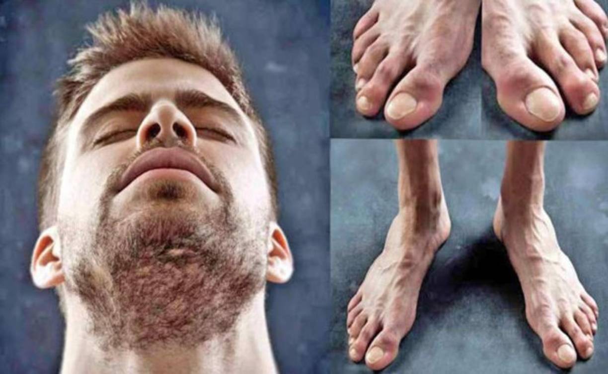 Gerard Piqué también entró a la lista de los deportistas con los pies más feos.