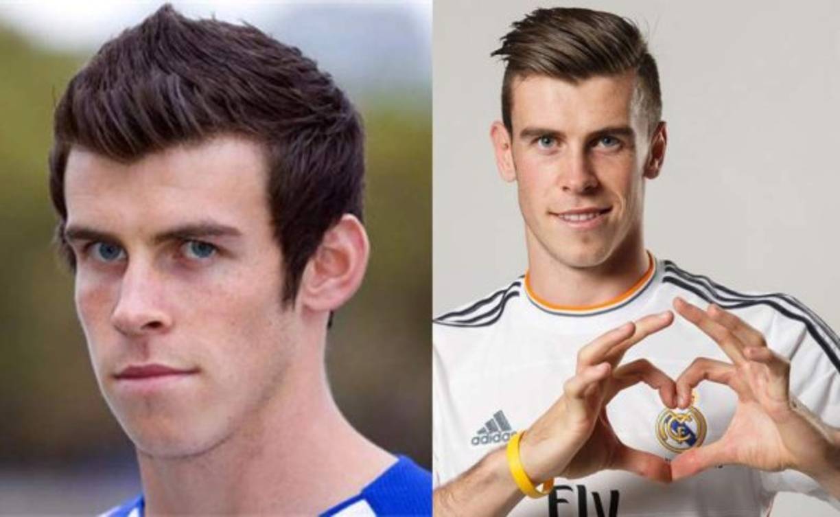 Gareth Bale se operó el tamaño de sus orejas cansado de que la gente se metiera con él desde niño. El truco de taparse las orejas con el cabello sólo dejaba más a la luz su complejo, así que se sometió a la otoplastia, operación común y muy sencilla.