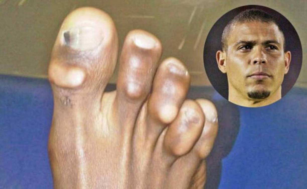 Ronaldo Nazario y sus horrendos pies, la fotografía la subió a sus redes sociales.