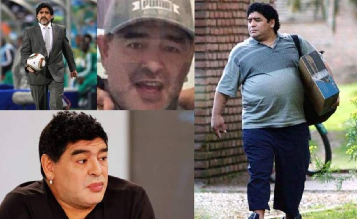 Diego Maradona se hizo un bypass gástrico para solventar los problemas de sobrepeso. Recientemente se practicó una cirugía estética facial en el rostro conocida como 'lifting' para rejuvenecer.