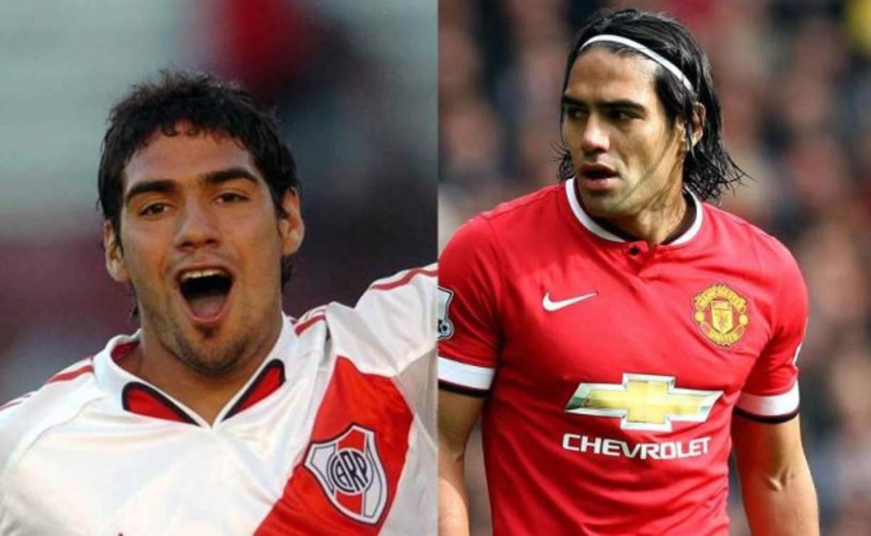 Radamel Falcao se sometió a una operación de nariz en 2014 para, además de mejorar su estética, también olvidar unos problemas respiratorios. Prensa de Argentina señala que ya antes se había arreglado las orejas y los dientes.