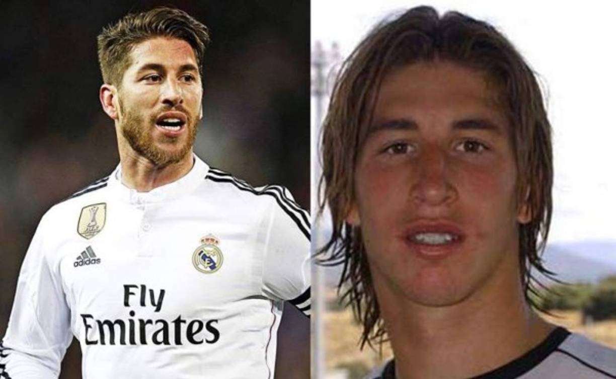 Sergio Ramos aprovechó una lesión en la nariz y se practicó la rinoplastia. También se arregló los dientes. Prensa española asegura que además se retocó los pómulos y las orejas. Ahora puede presumir de ser uno de los más guapos del fútbol.