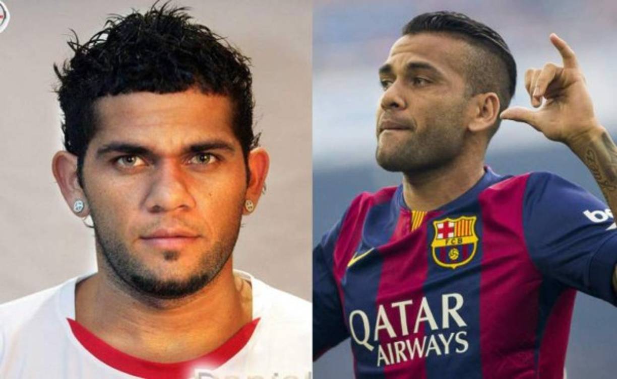 El brasileño Dani Alves se redujo en 2009 la nariz y las orejas; lo de hacerse moderno, vino después.
