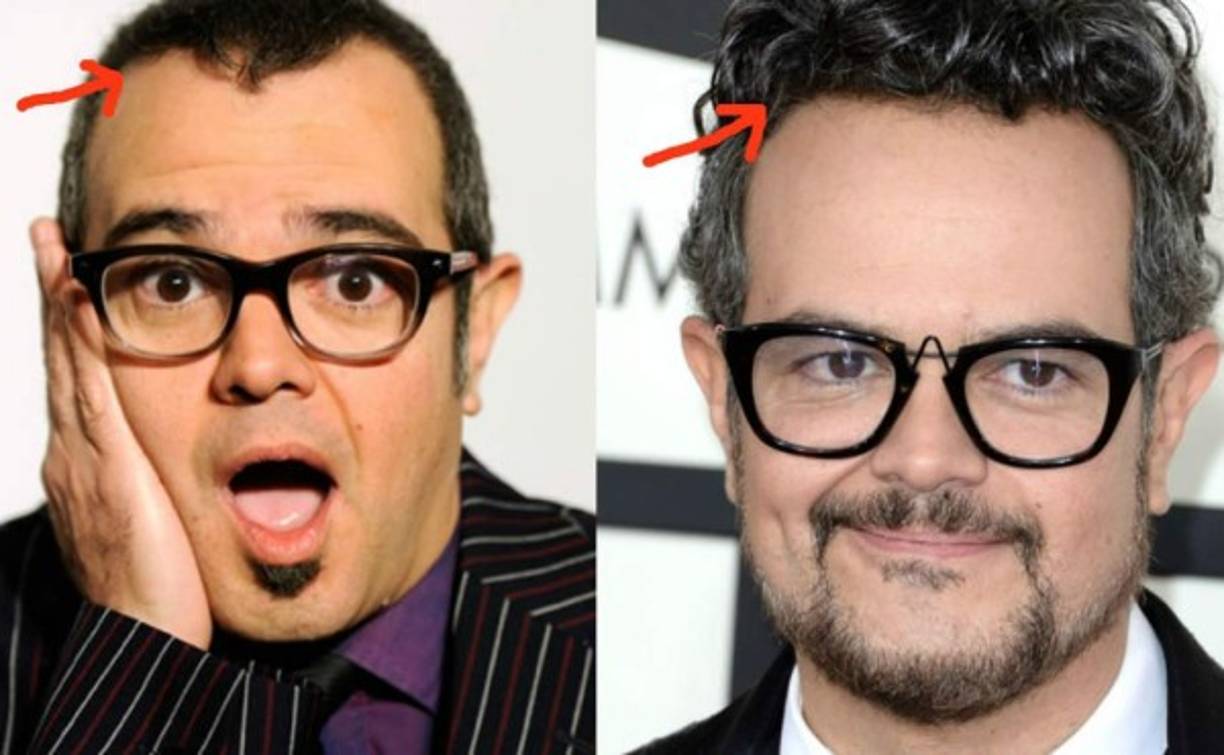 Además del injerto de cabello, Syntek también bajó de peso y se hizo algunos cambios de peluquería.