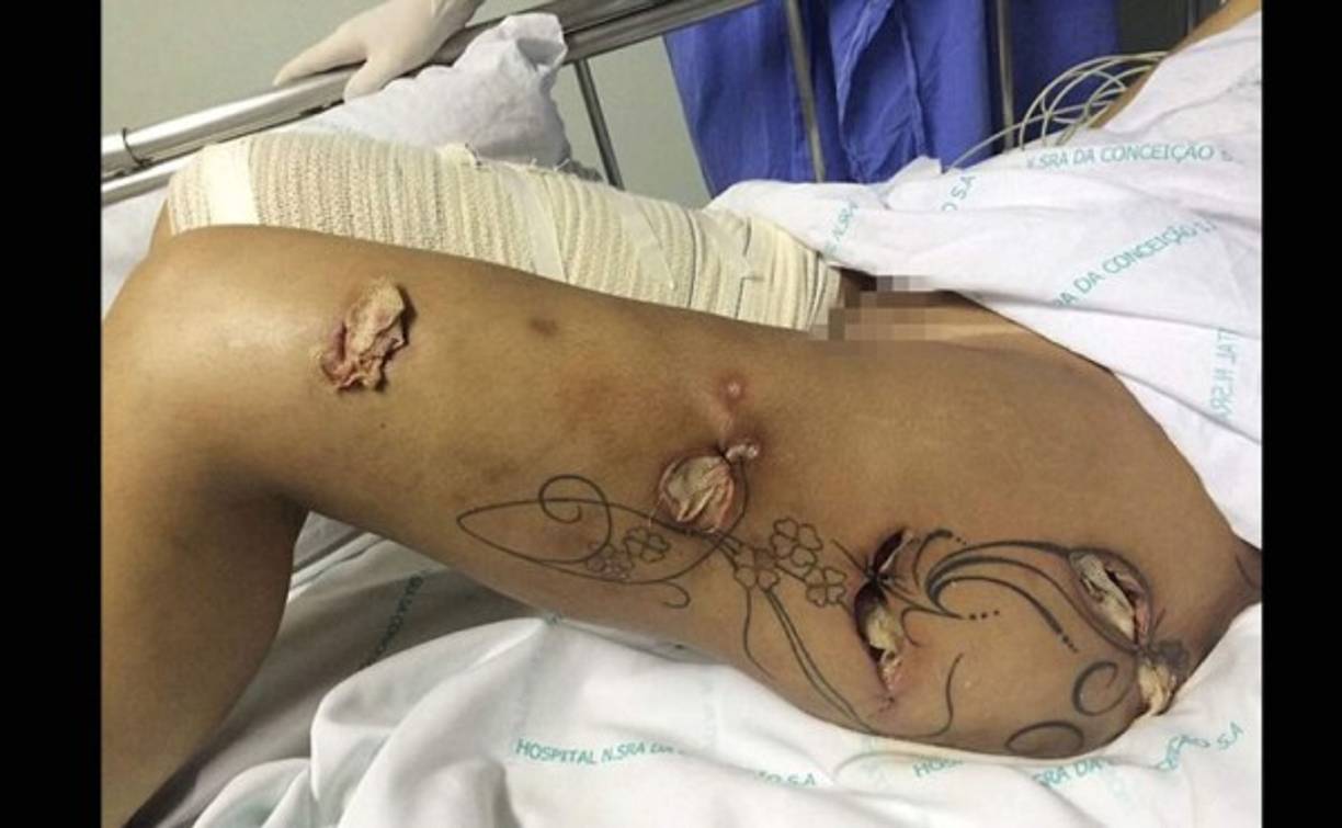 Andressa ha pasado una larga temporada en el hospital.