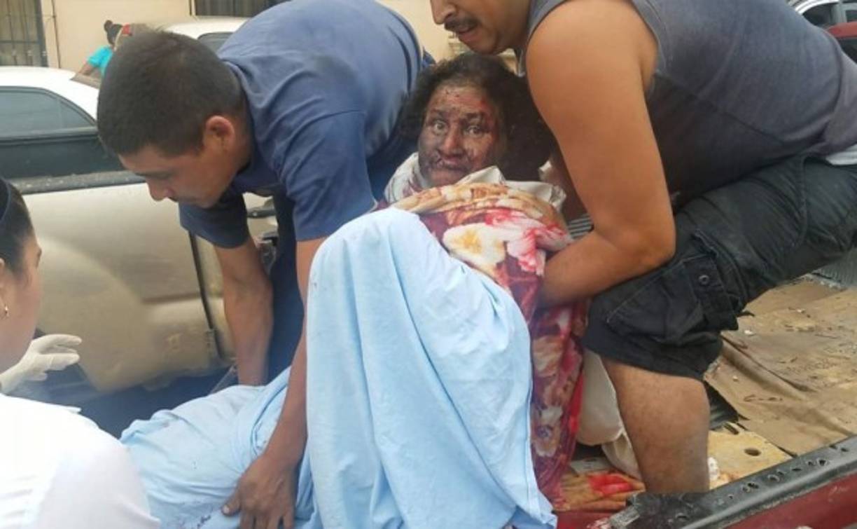 Una explosión en una cohetería de la comunidad de Nueva Arcadia, departamento de Copán, dejó dos personas muertas y dos heridas.