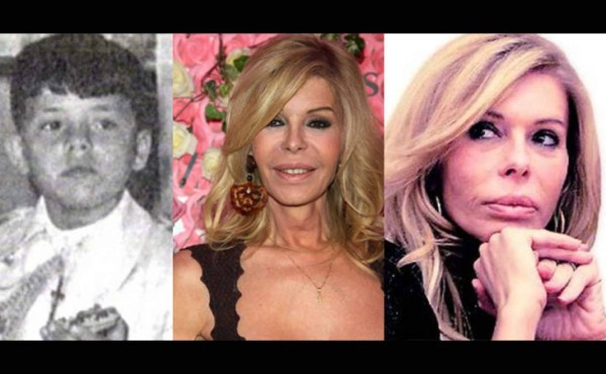 Fetiche de Almodovar (hoy Bibiana Fernández) nació como Manuel Fernández Chica. Apenas pasada su adolescencia, comenzó su transformación hacia el sexo opuesto, se sometió a tratamiento hormonal con estrógenos y, luego, a una vaginoplastia.