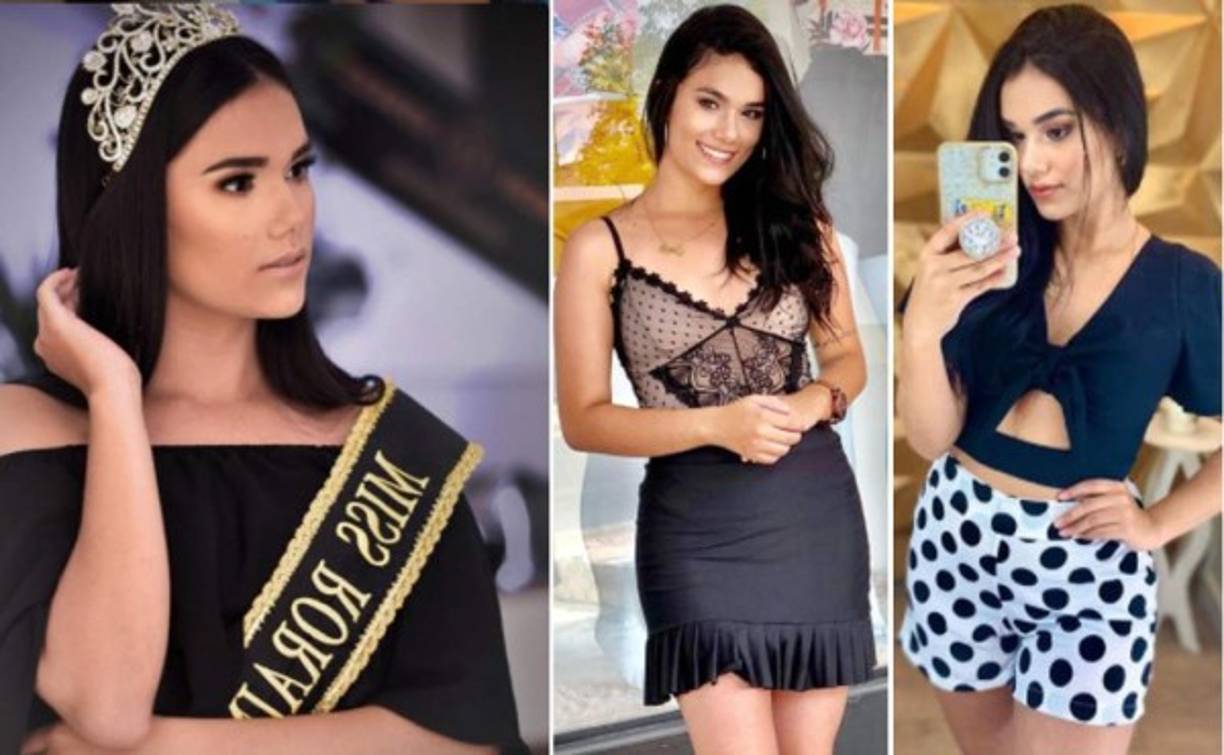 Vanessa Soares, la reina de belleza brasileña, murió durante la cirugía para extirpar un tumor en Roraima, Brasil.