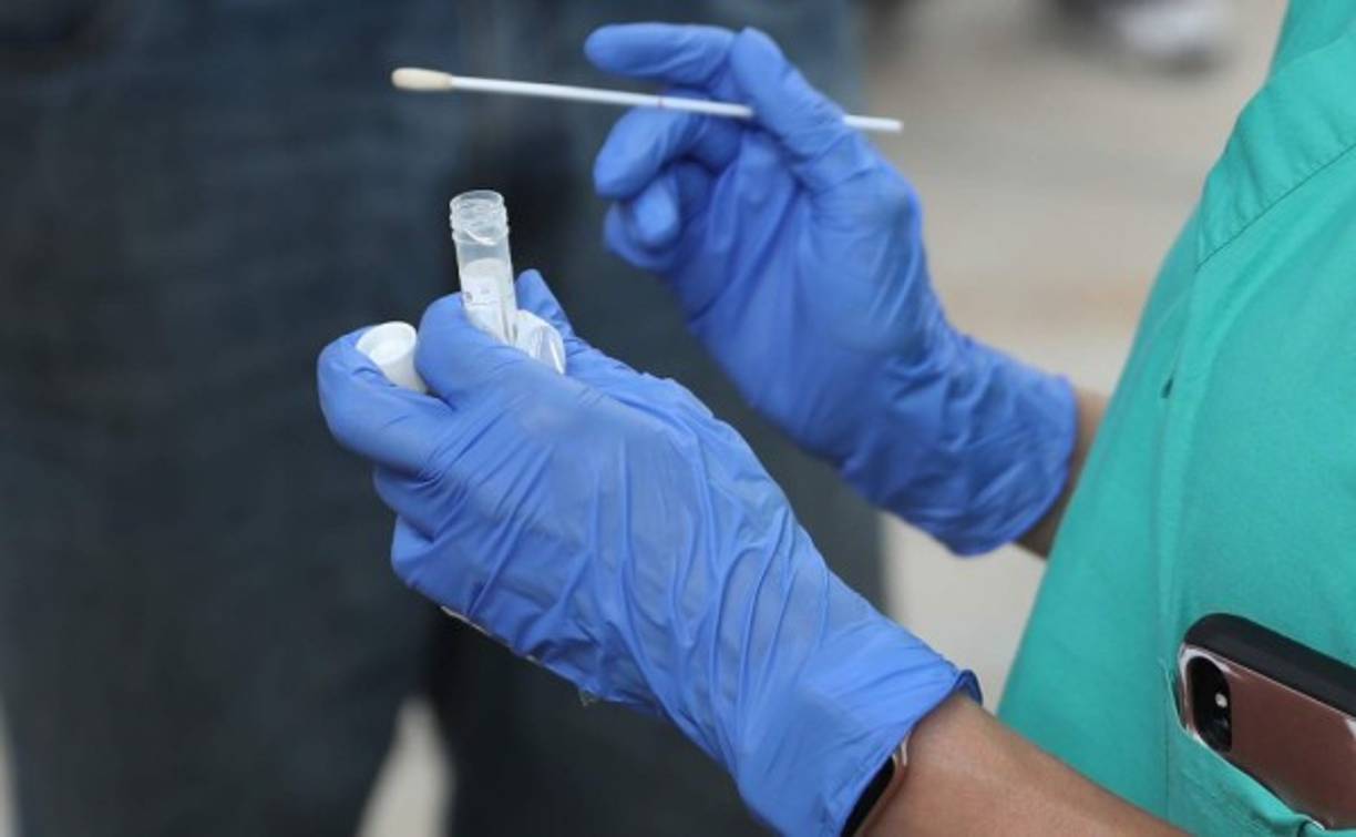 También hay otros síntomas asociados con el coronavirus pero que no han sido oficializados como tales.