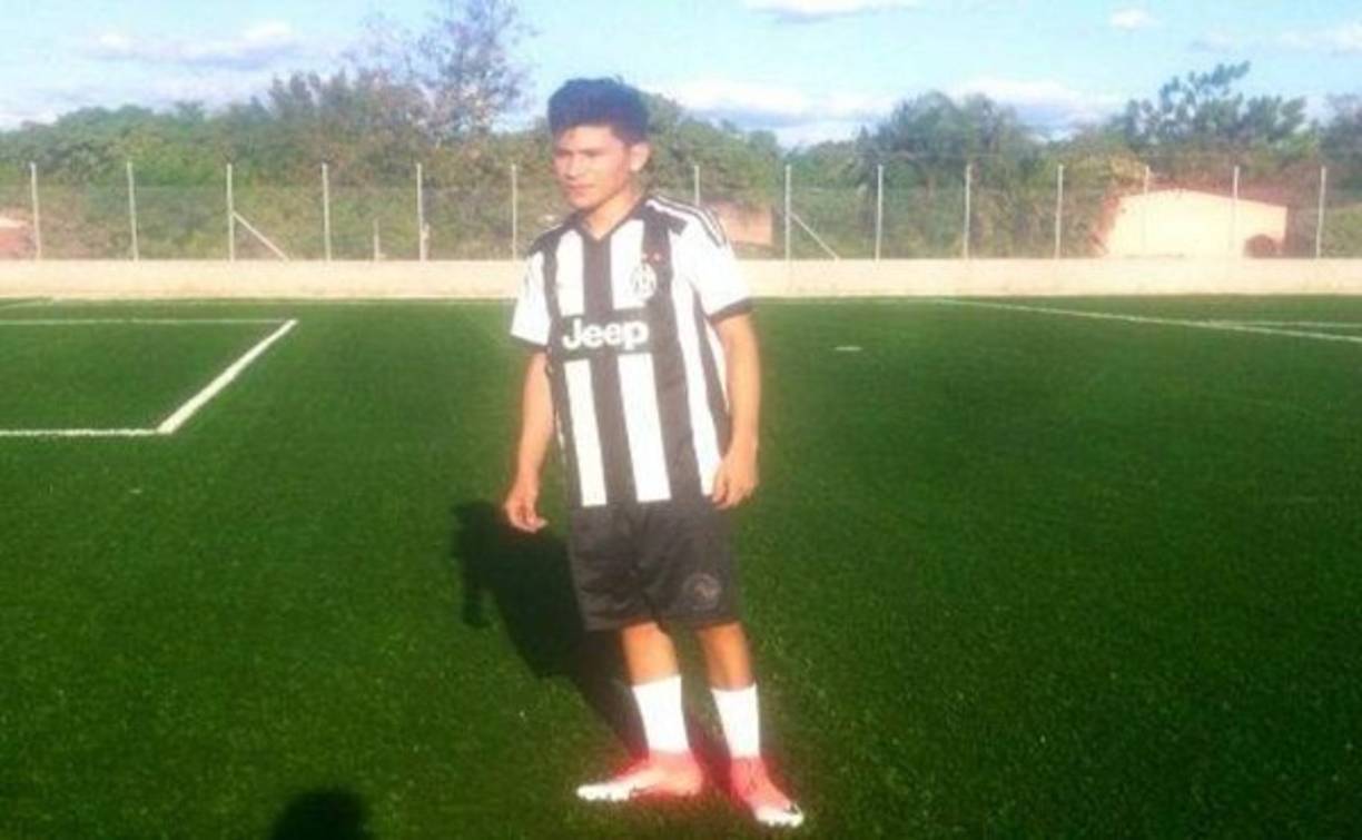 Médicos del Hospital Escuela informaron que el joven perdió su ojo izquierdo, su nariz y una parte de sus labios.