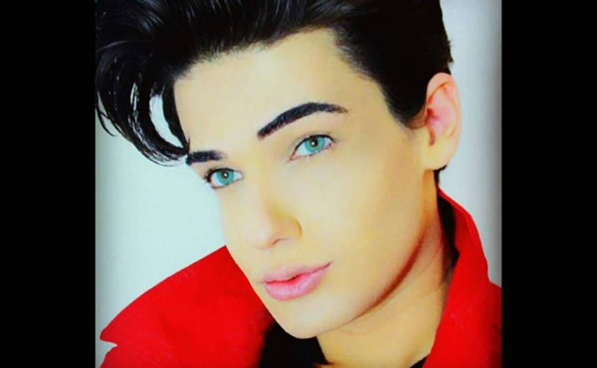 Esta operación fue solo una de las tantas que se practicó para parecerse al famoso muñeco.