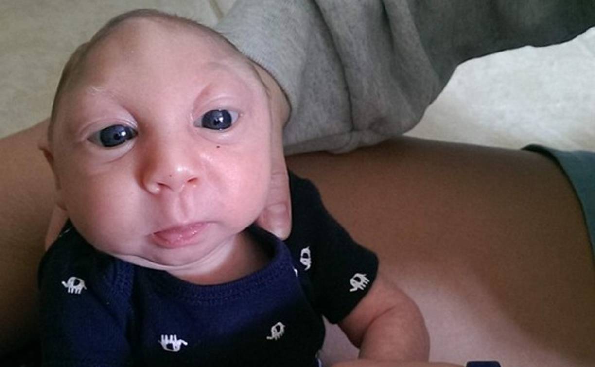 De su nacimiento y por ganas de vivir que ha mostrado sus padres le crearon su página en Facebook donde ya tiene más de 90,000 likes.