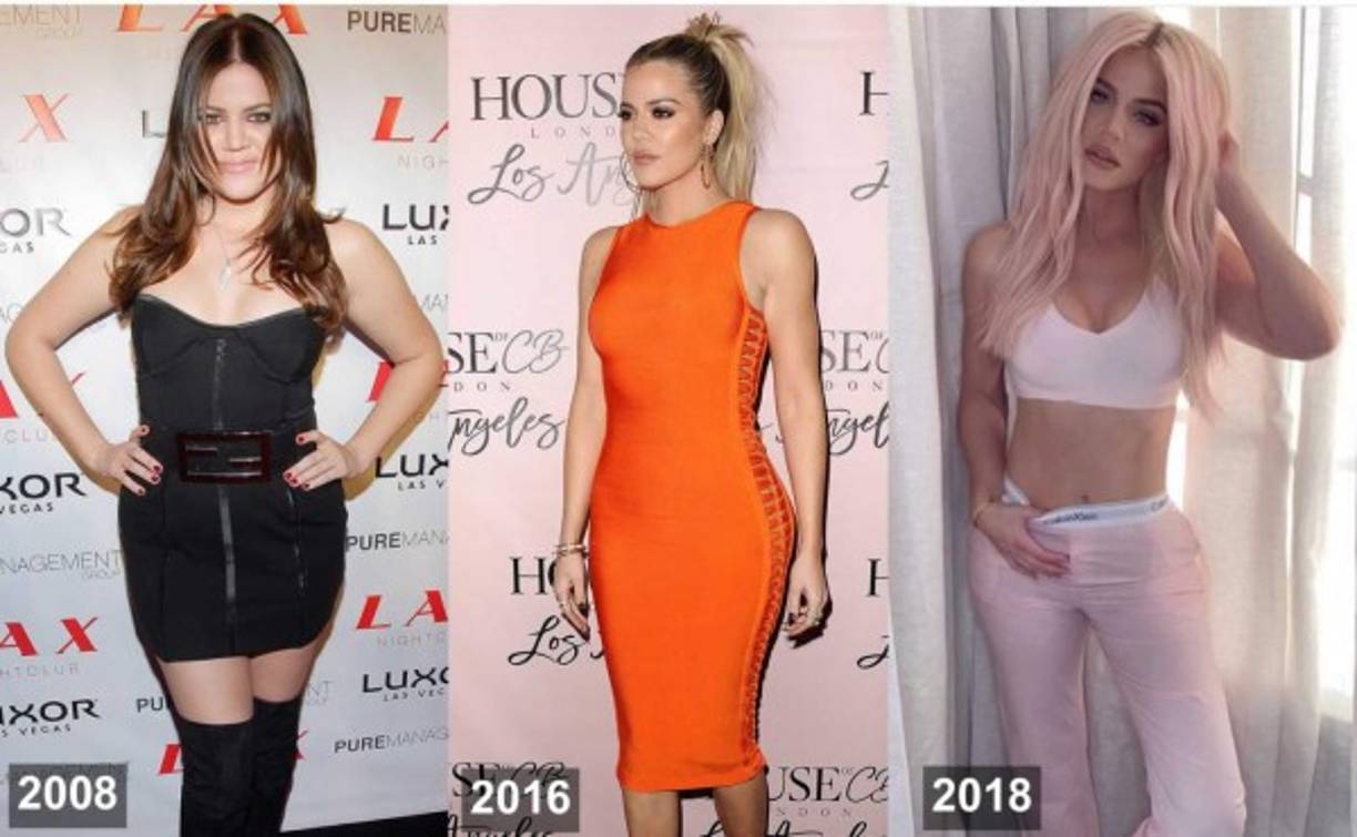 Según el portal NW, la estrella televisiva está obsesionada con la cirugía y ha gastado más de $ 2 millones para lograr que su rostro sea tan perfecto como los filtros de las redes sociales.