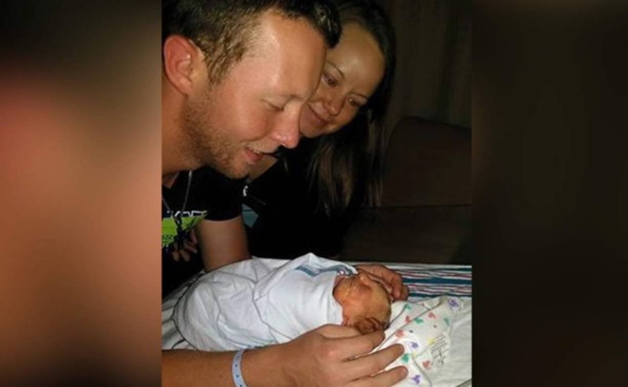 Nunca de dieron por vencidos e ignoraron las recomendaciones de los médicos. Al principio saber que su bebé tenía solo medio cerebro y medio cráneo fue duró, pero el amor lo superó todo.