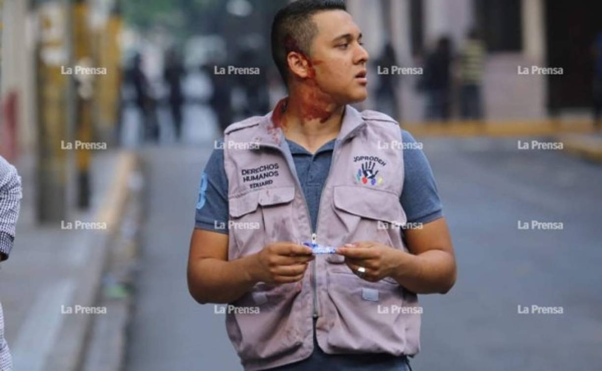Un representante de los Derechos Humanos resultó herido en los enfrentamientos.