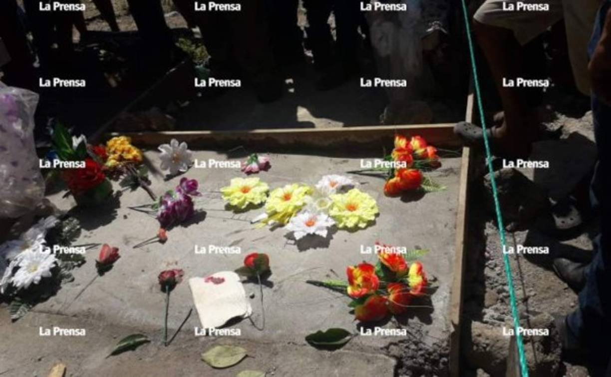 La increíble historia comenzó cuando los humildes padres del niño que nació con la condición llamada albina o mejor conocida en Honduras como 'hijo del sol' lo llevaron a la clínica 'Los Ángeles' ubicada en las cercanías de la comunidad donde vive la pareja de campesinos.