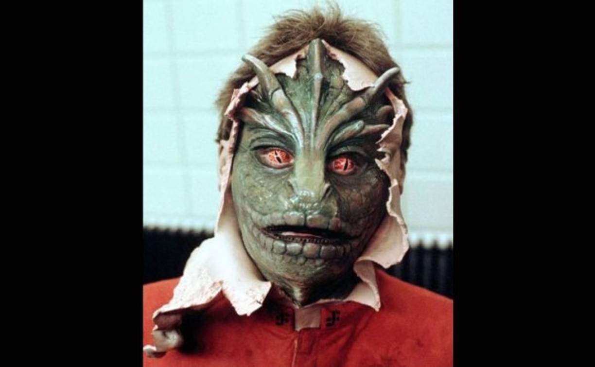 'A Camilo Sesto casi no se le nota la cirugía...'.