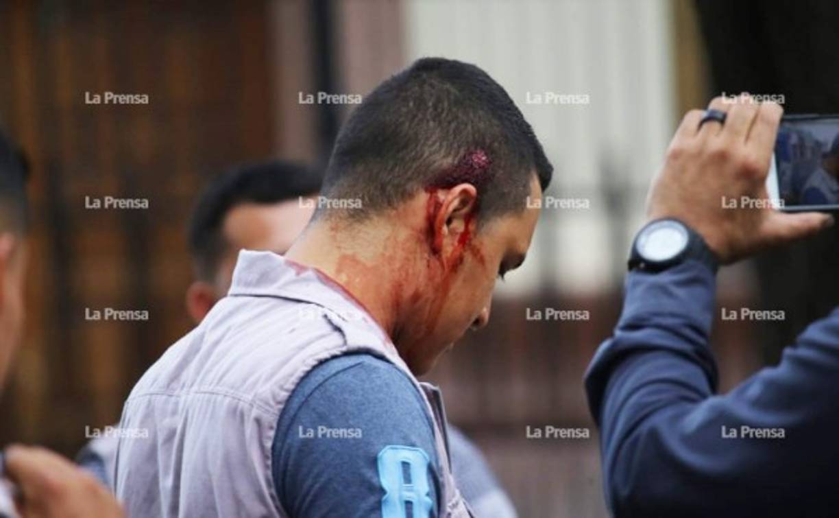 Las protestas por el rechazo a los decretos que buscaban reestructurar la Secretaría de Educación y Salud en Honduras han dejado millonarias pérdidas y varias personas lesionadas.