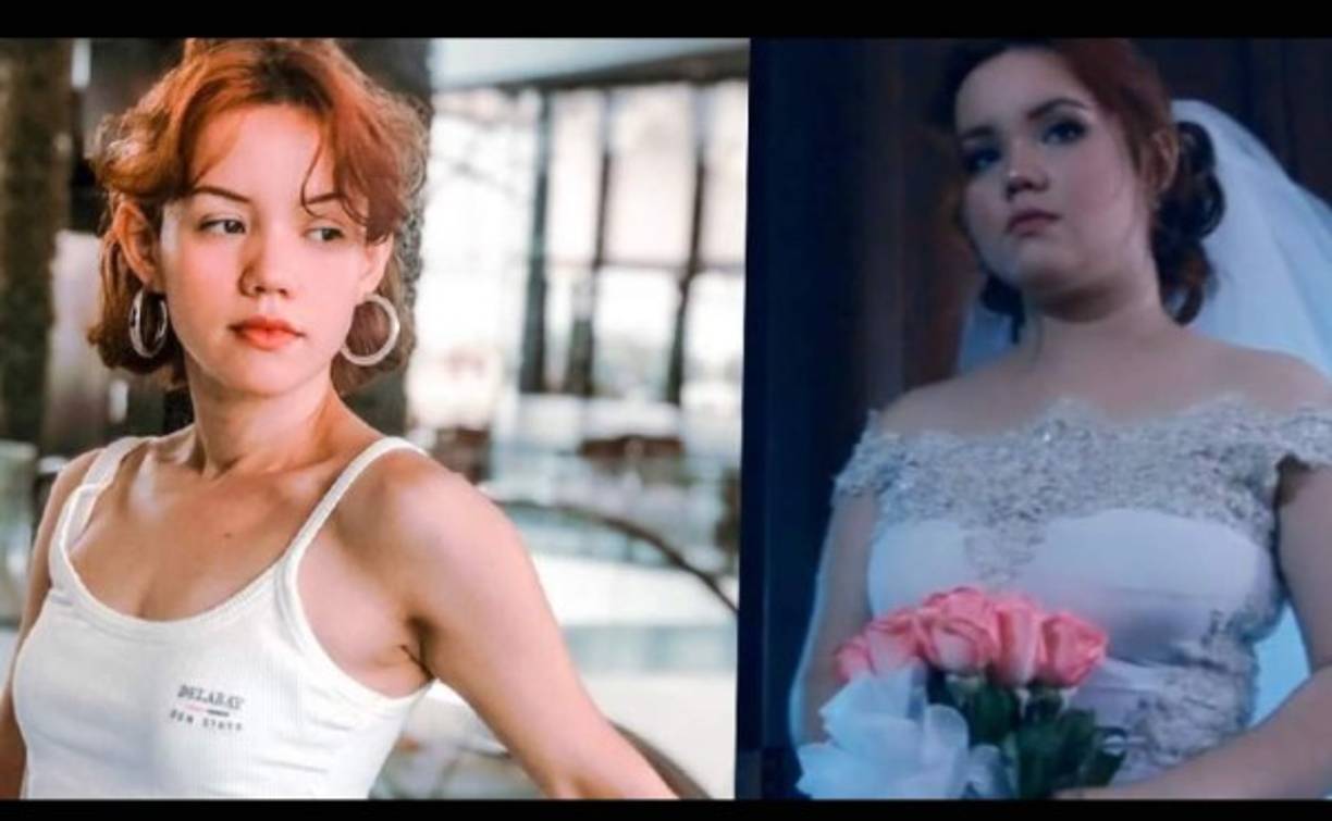 En publicación hecha en Instagram, Dalú explica que perdió 24 kilos, más de 50 libras de sobrepeso, y aunque logró bajar de peso su cuerpo quedó con algunas secuelas como estrías y piel flácida.