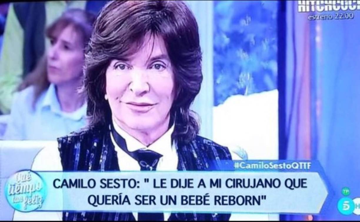 En Internet circulan una serie de memes sobre las cirugías que se ha sometido el cantante.