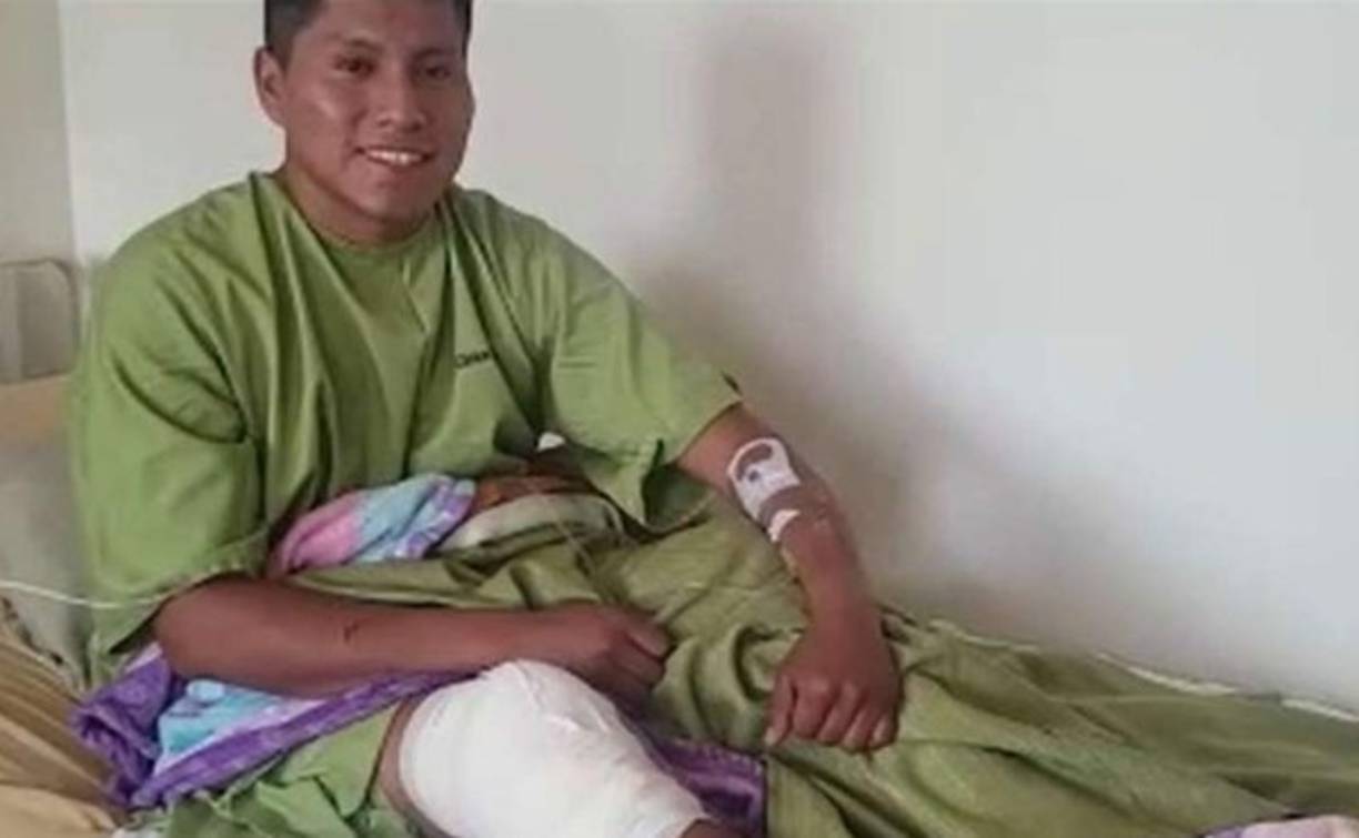 Edwin Tumiri, uno de los sobrevivientes de este accidente de tránsito, vive no una segunda vida, sino una tercera, porque fue uno de los seis sobrevivientes de la tragedia del Chapecoense en 2016.