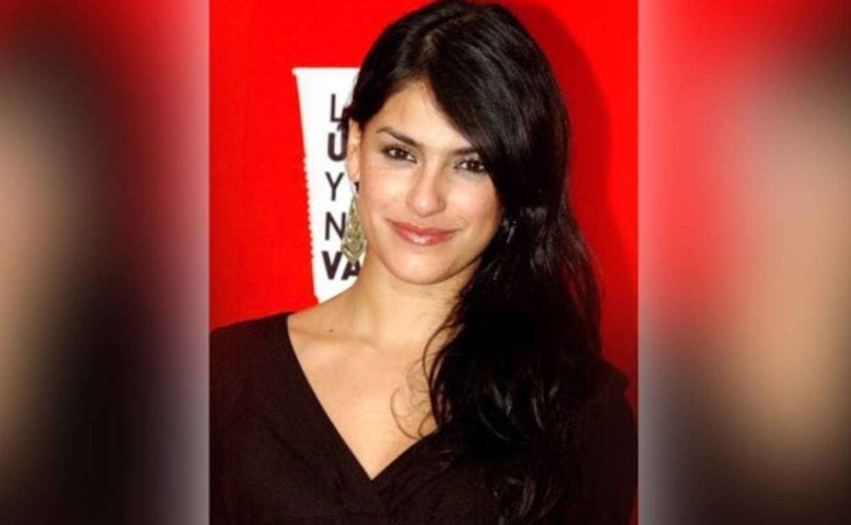 La actriz mexicana Liz Gallardo sufrió graves consecuencias en el rostro después de someterse a un tratamiento de belleza.