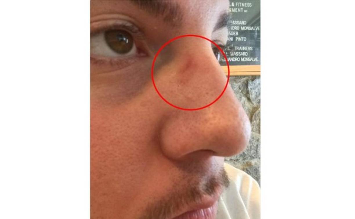 Una marca que nunca desaparecerá.