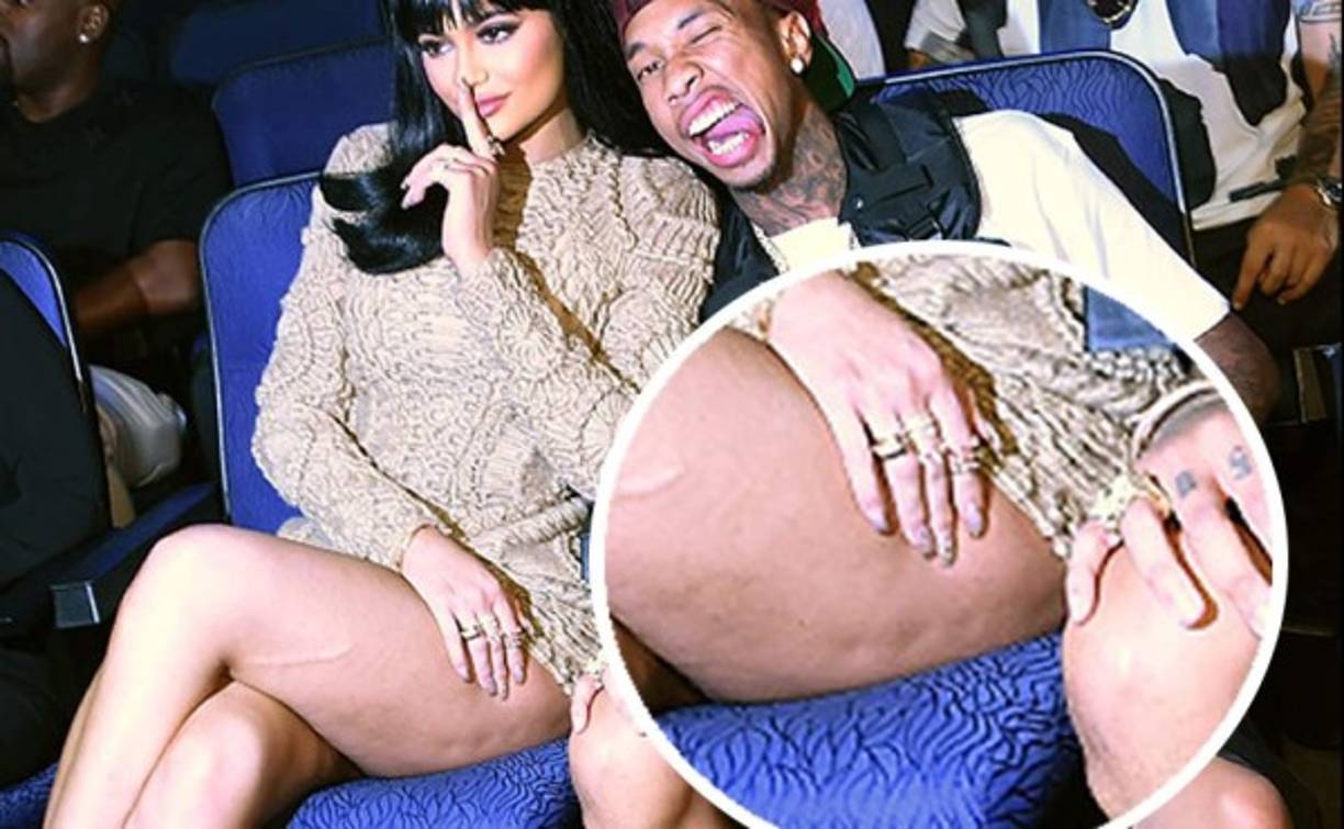 En la entrega de los MTV dejó al descubierto su celulitis.