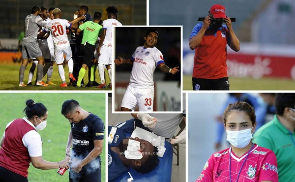 Las imágenes que dejó la disputa de la cuarta jornada del Torneo Apertura 2020-2021, cerrando con el clásico Motagua-Olimpia.